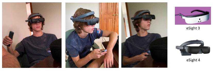 Visually impaired male teenager with technical device called eSight on his head and over his eyes